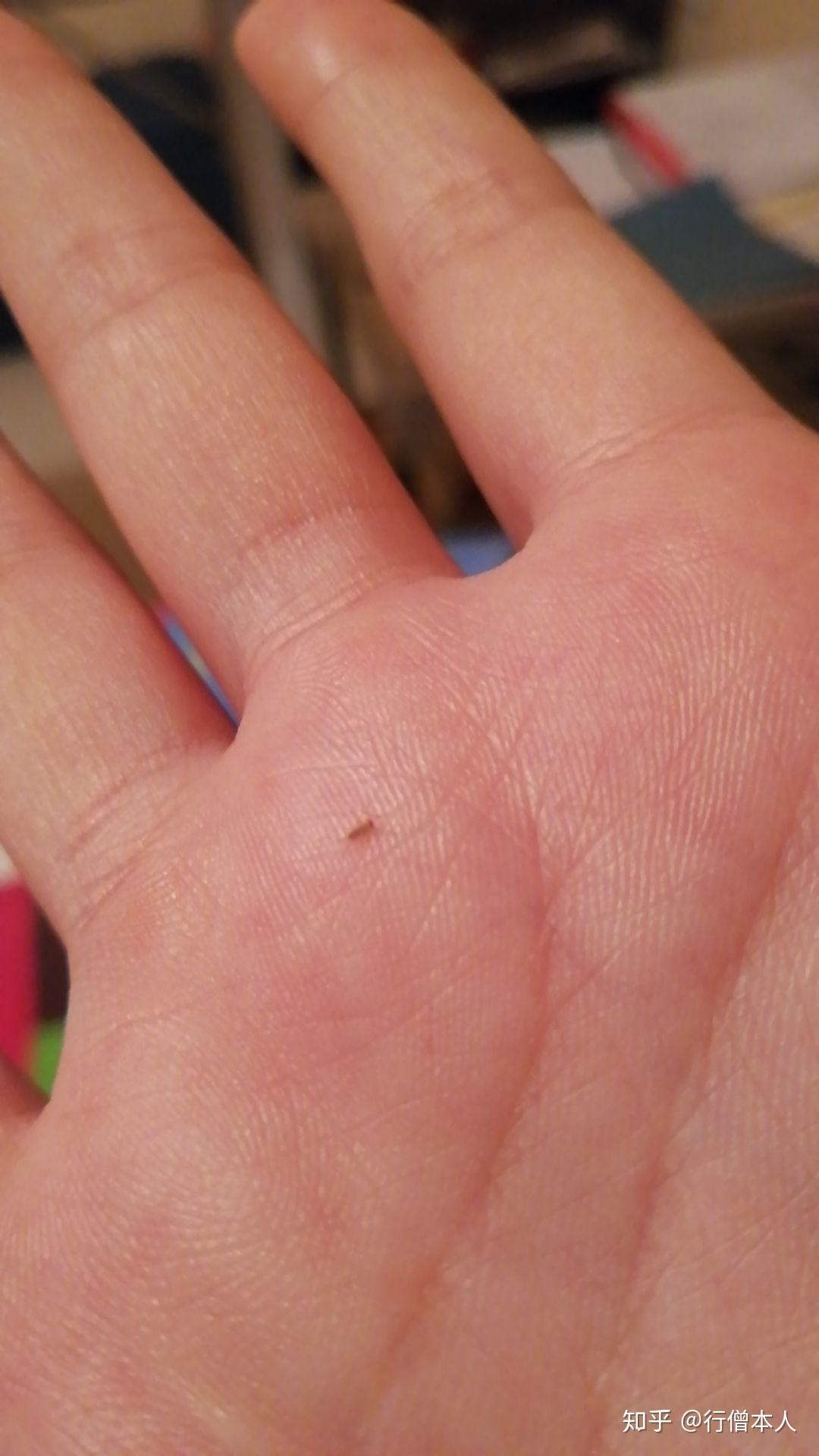 租的房子里出现这种小虫子