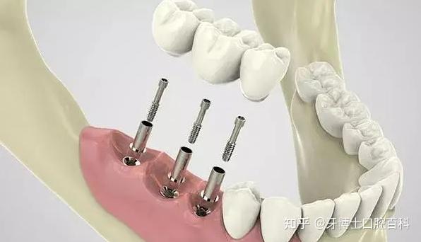 包含北大口腔醫院、順義區產科建檔價格——靠譜的代掛號販子的詞條