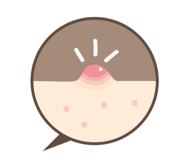 额头长那种红肿硬的痘痘,半个多月也没消,也不冒白头,我怎么才能让