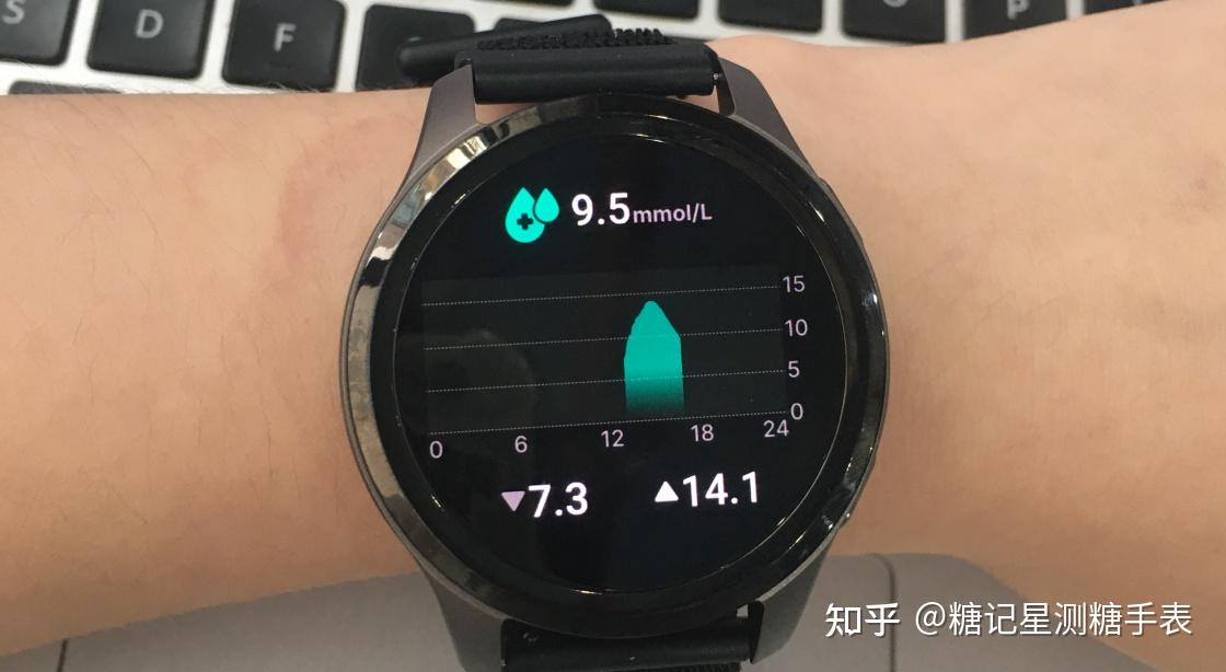 测糖智能手表是智商税?90 天亲身实测糖记星,告别天天扎手指,平替入门动态血糖仪