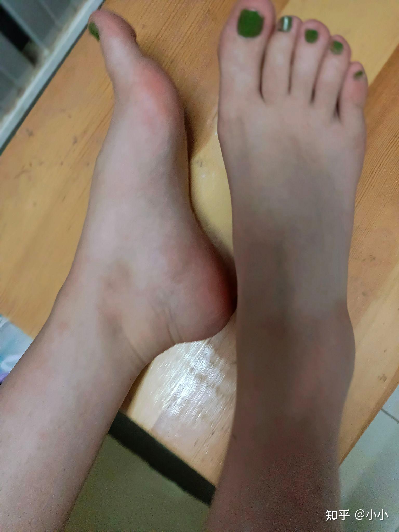 什么样的脚丫子才是最好看的? - 知乎