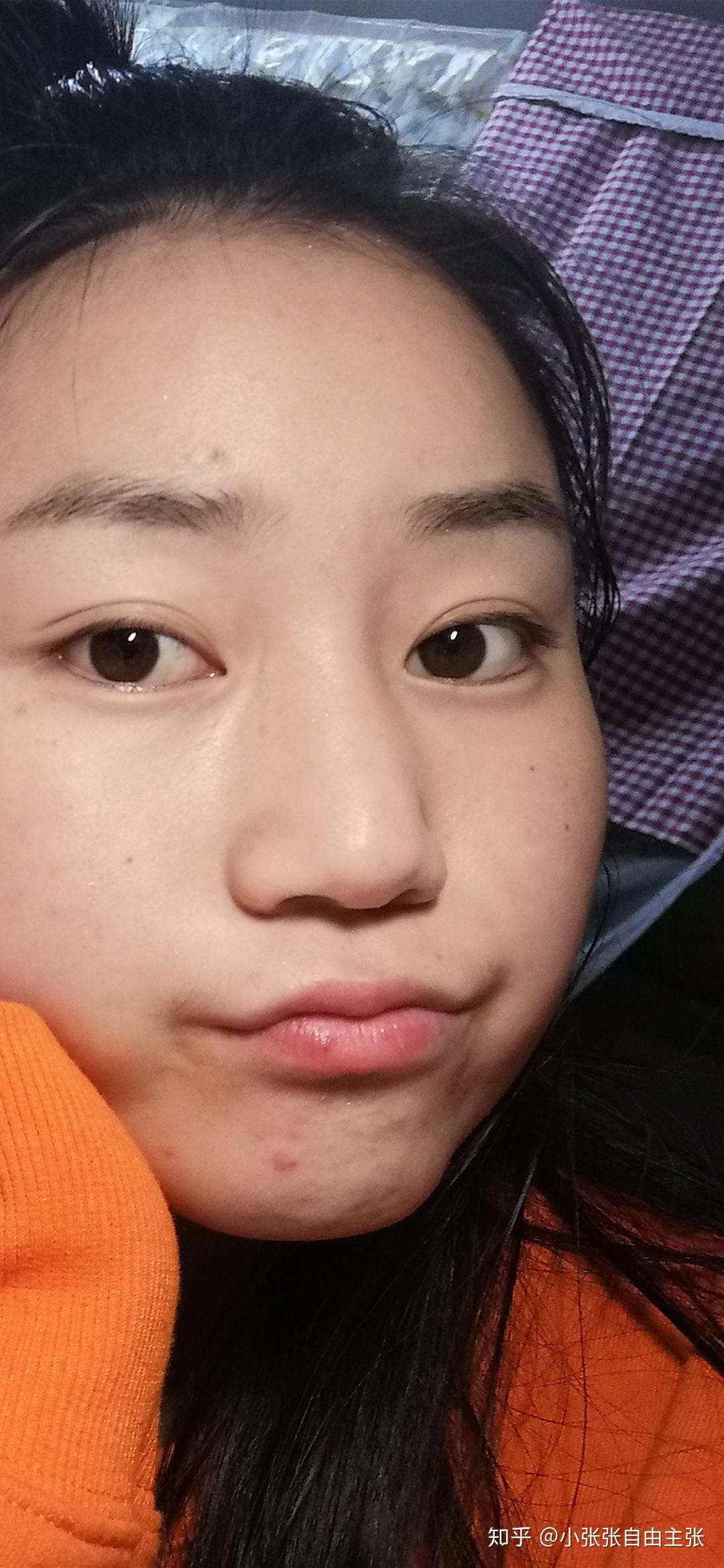 嘴巴小嘴唇薄笑起来不好看怎么办