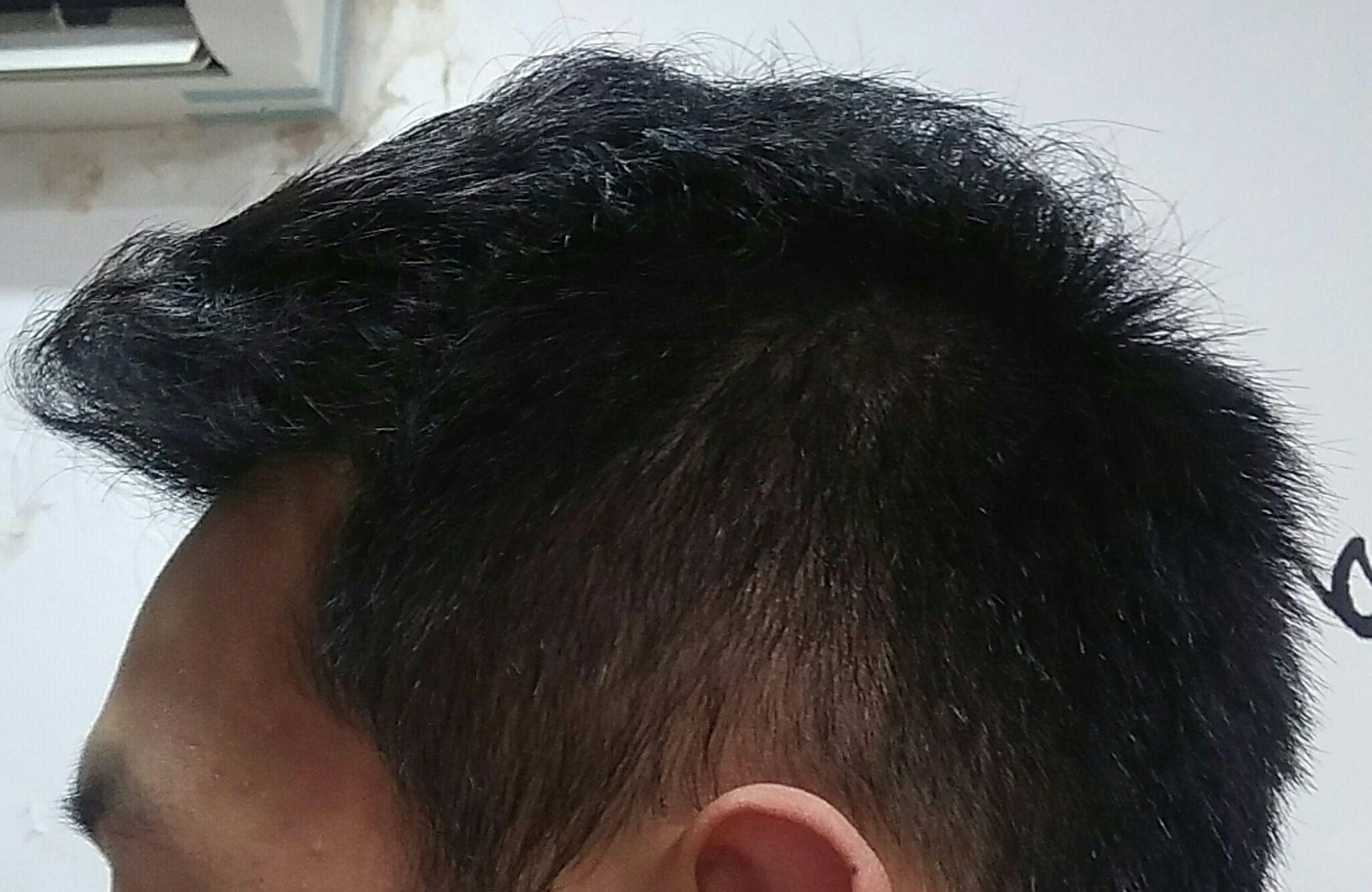 发际线高且m型发际线的男人适合什么发型额头较大