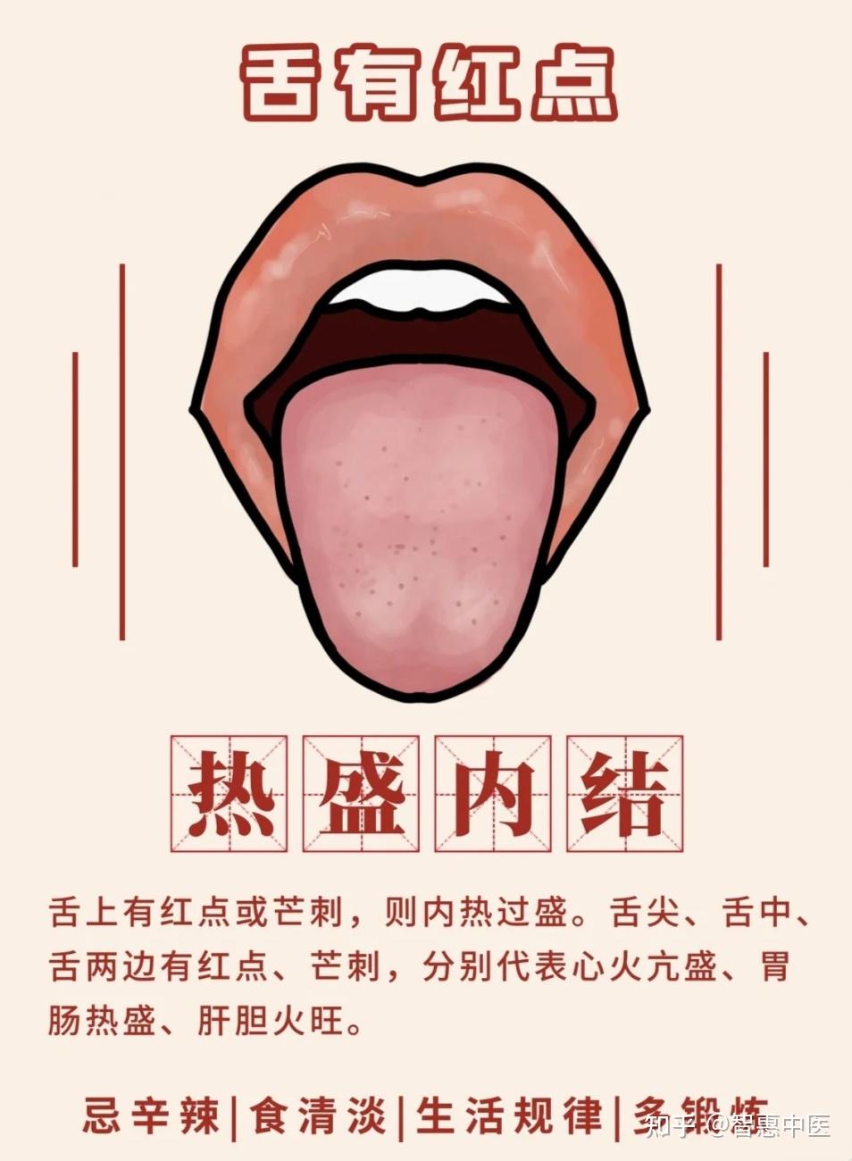 从舌苔看健康,跟中医学舌诊…… - 知乎