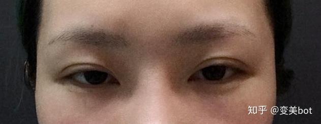 为什么有的人眼睛无神或者说无神的眼睛有什么特点