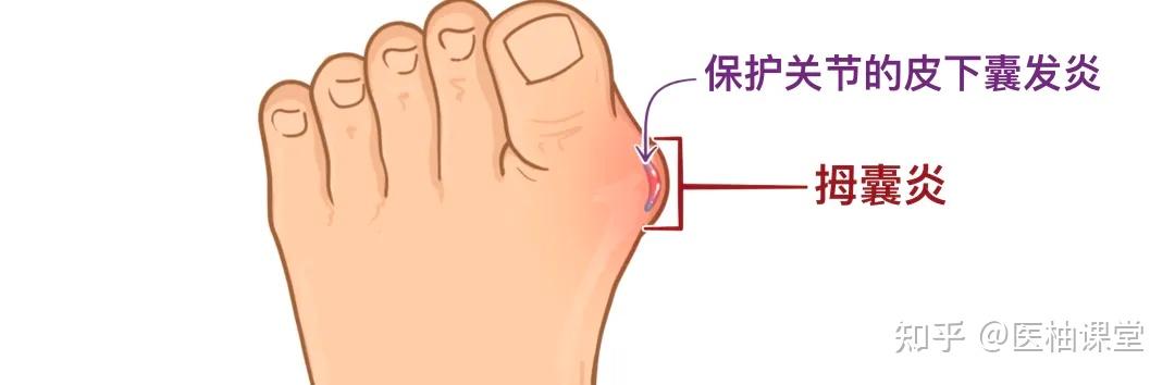 人体解剖学基础：足部 - 知乎