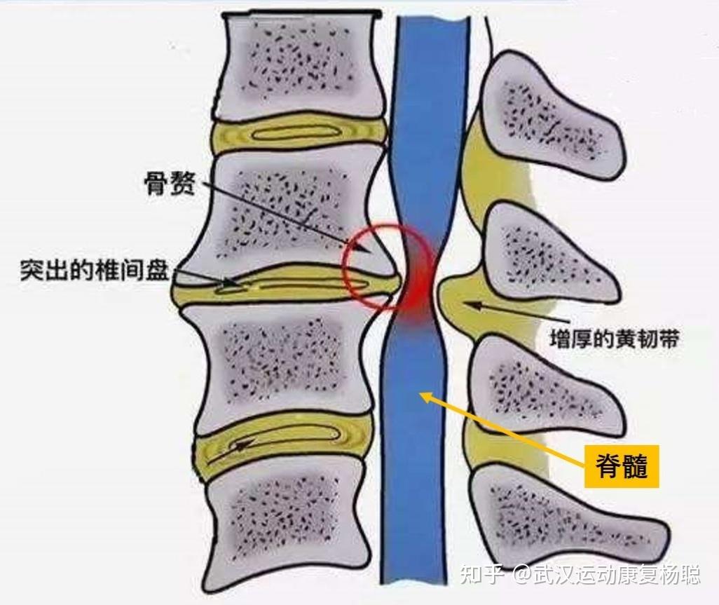 黄韧带与硬脊膜解剖图图片