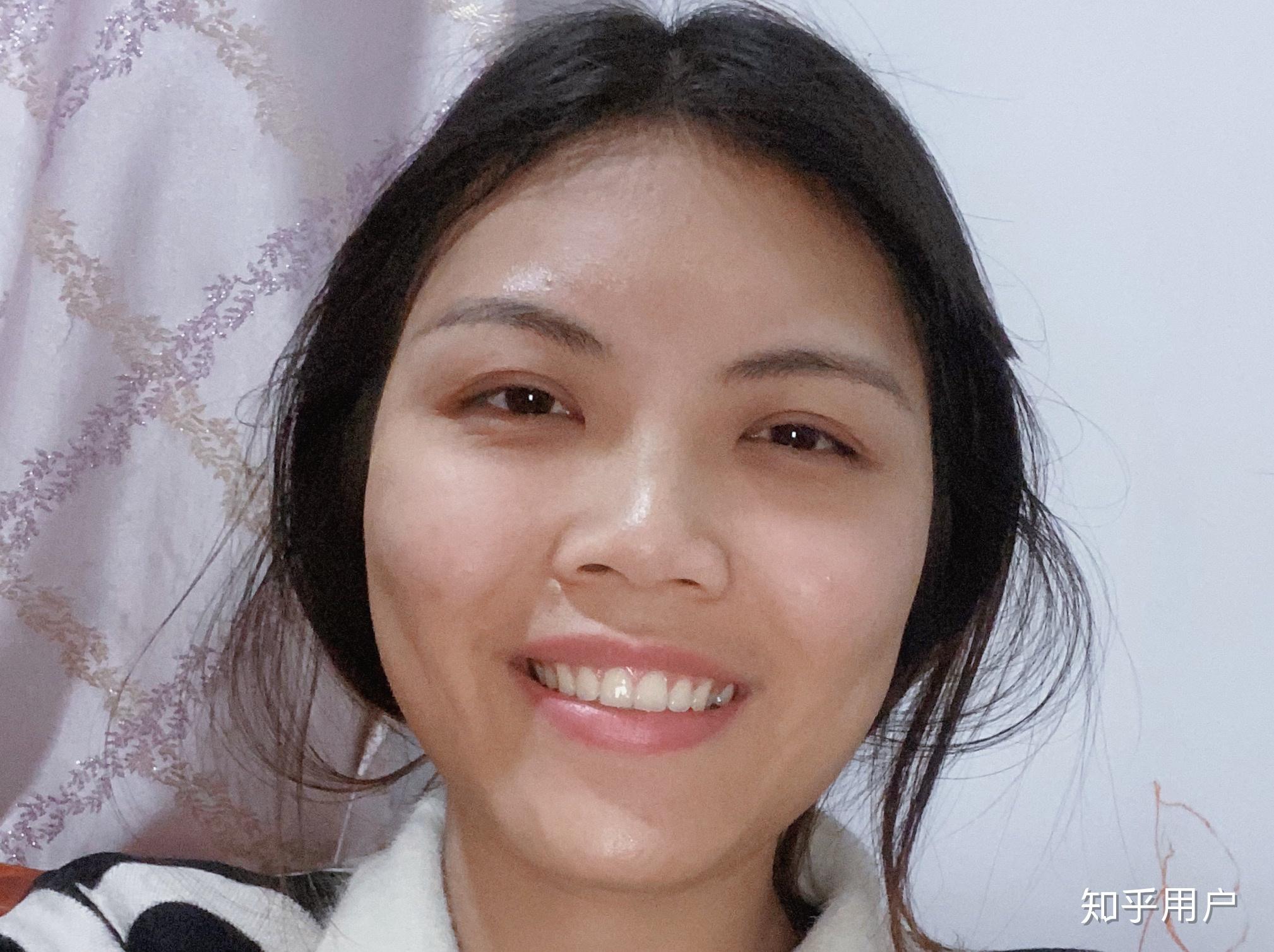 笑起来腮帮子就很鼓,不好看怎么办? - 知乎