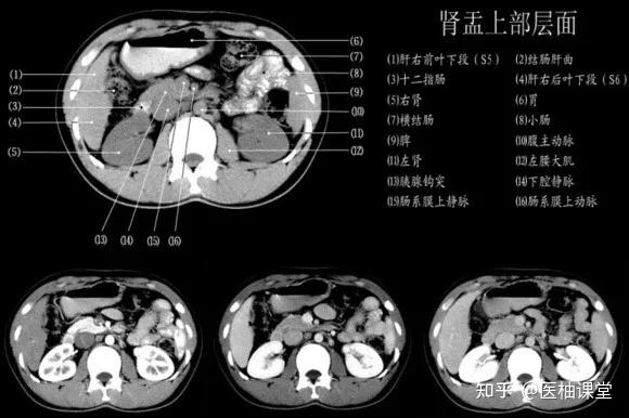 【经典】1小时读懂腹部CT - 知乎