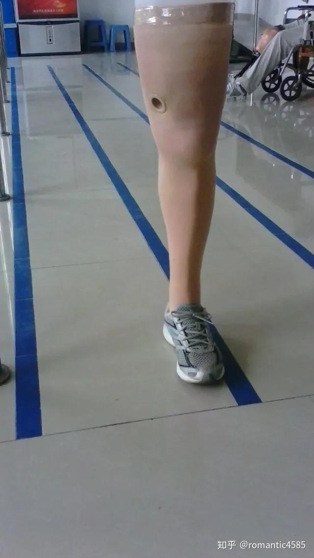 为什么有些人腿假肢会露出钢管