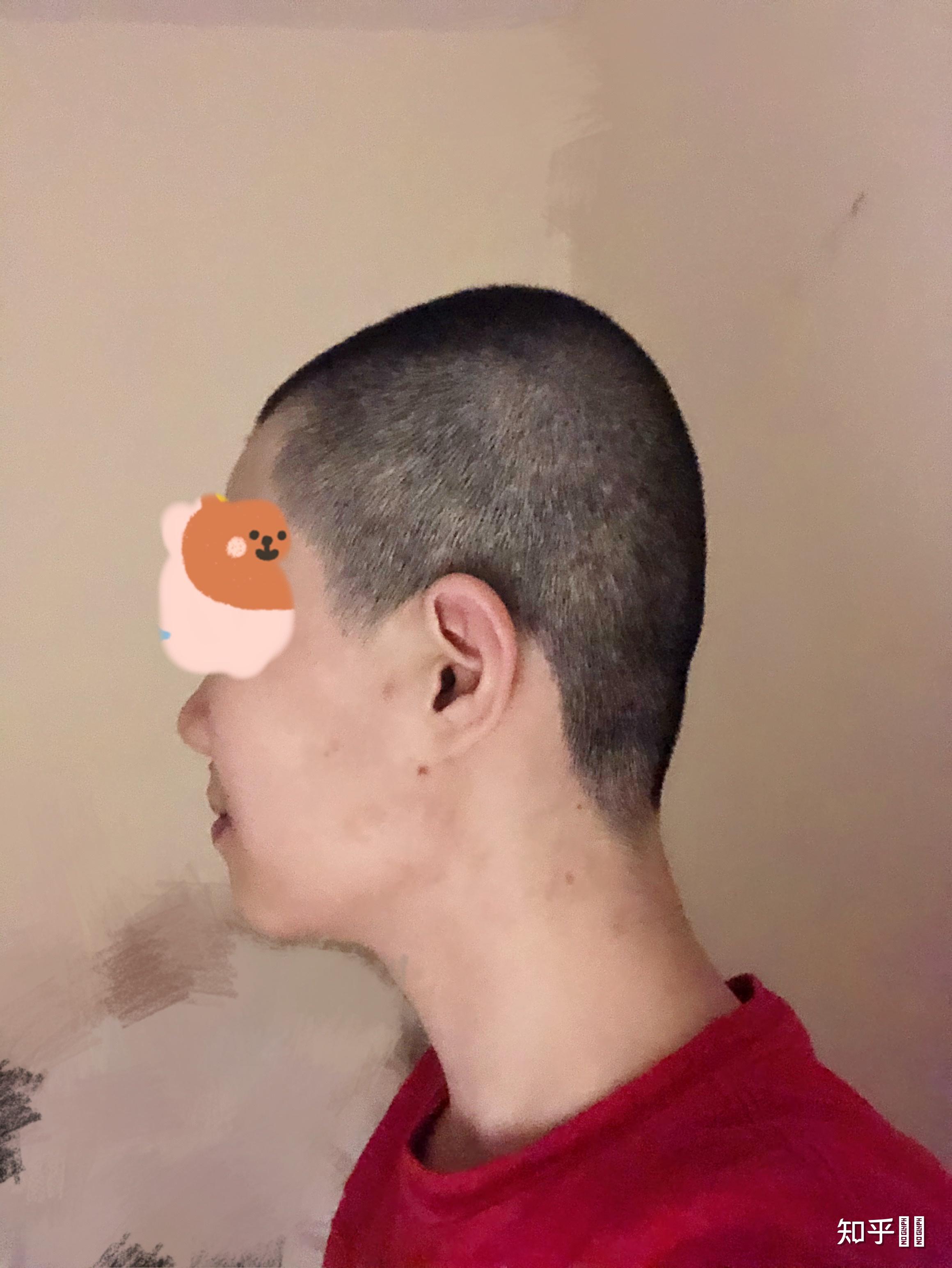 扁头女生是不是不好看?