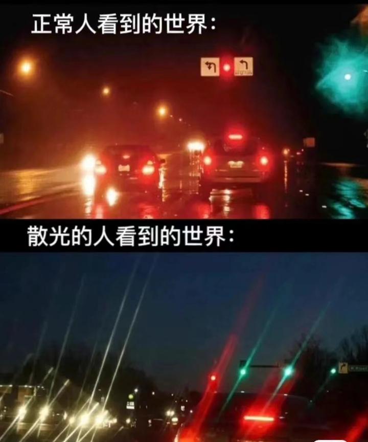 散光恢复矫正亲身经历告诉你，散光降了50度！ - 知乎