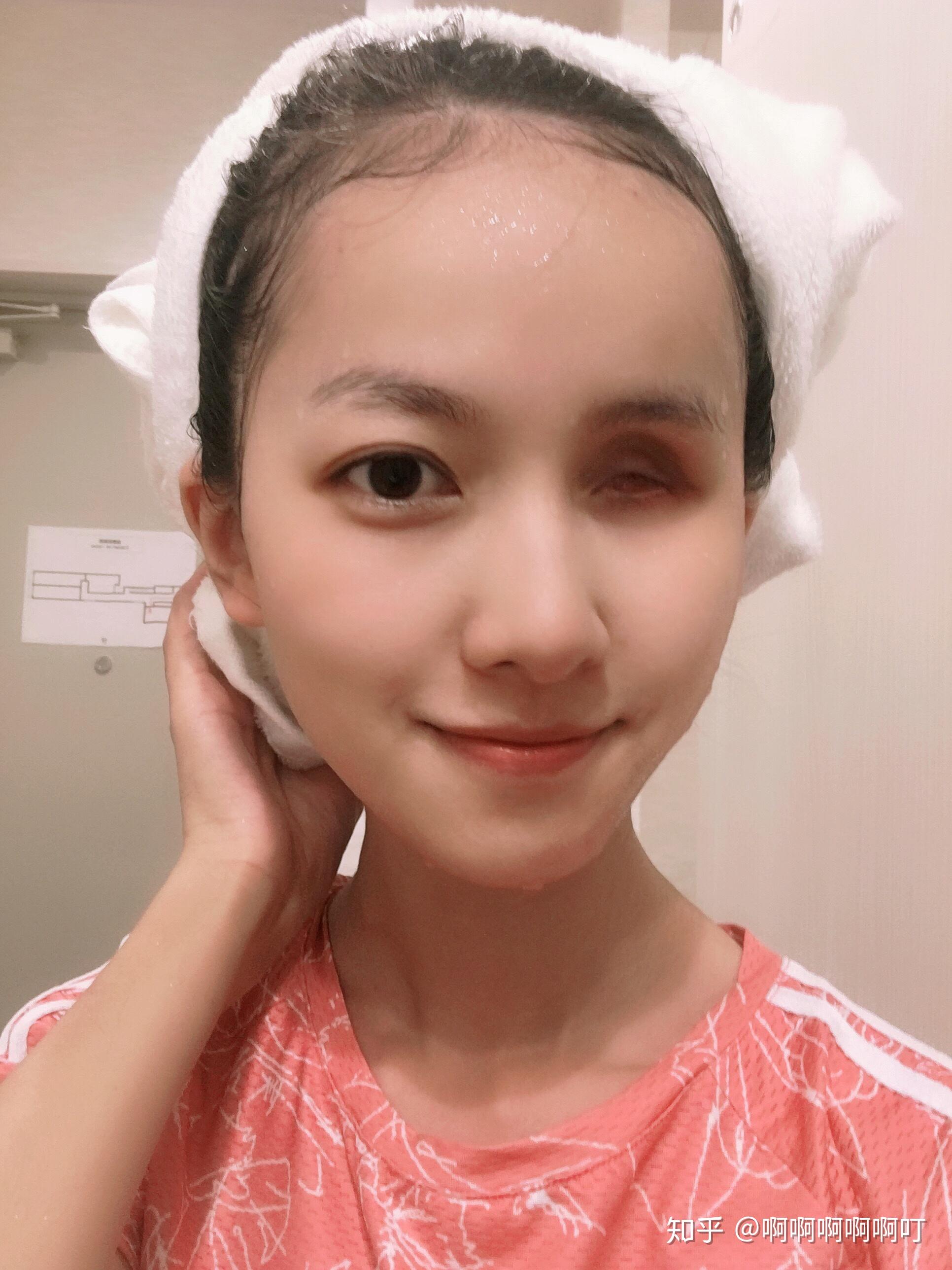 单眼失明是种怎样的体验