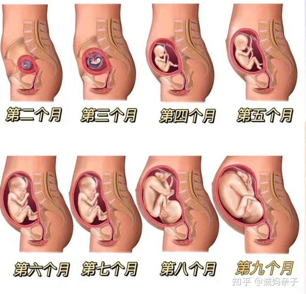 宫内怀孕图片