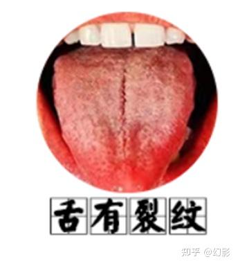 诊断之望诊 - 知乎