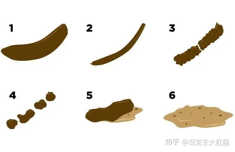 长期大便不成形是病吗?如何缓解? - 知乎