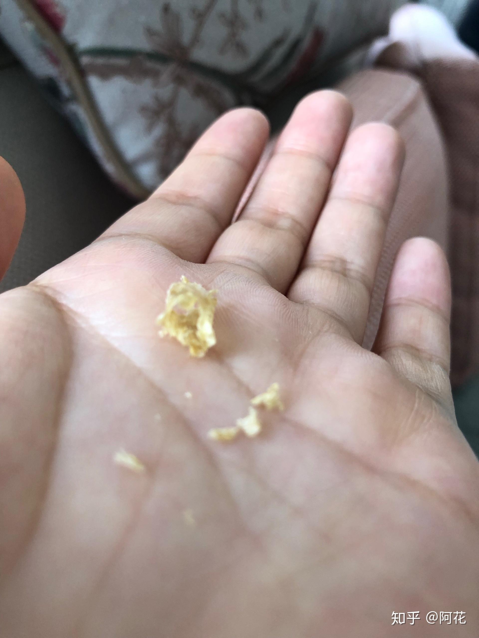 耳屎能大到什么程度? - 知乎