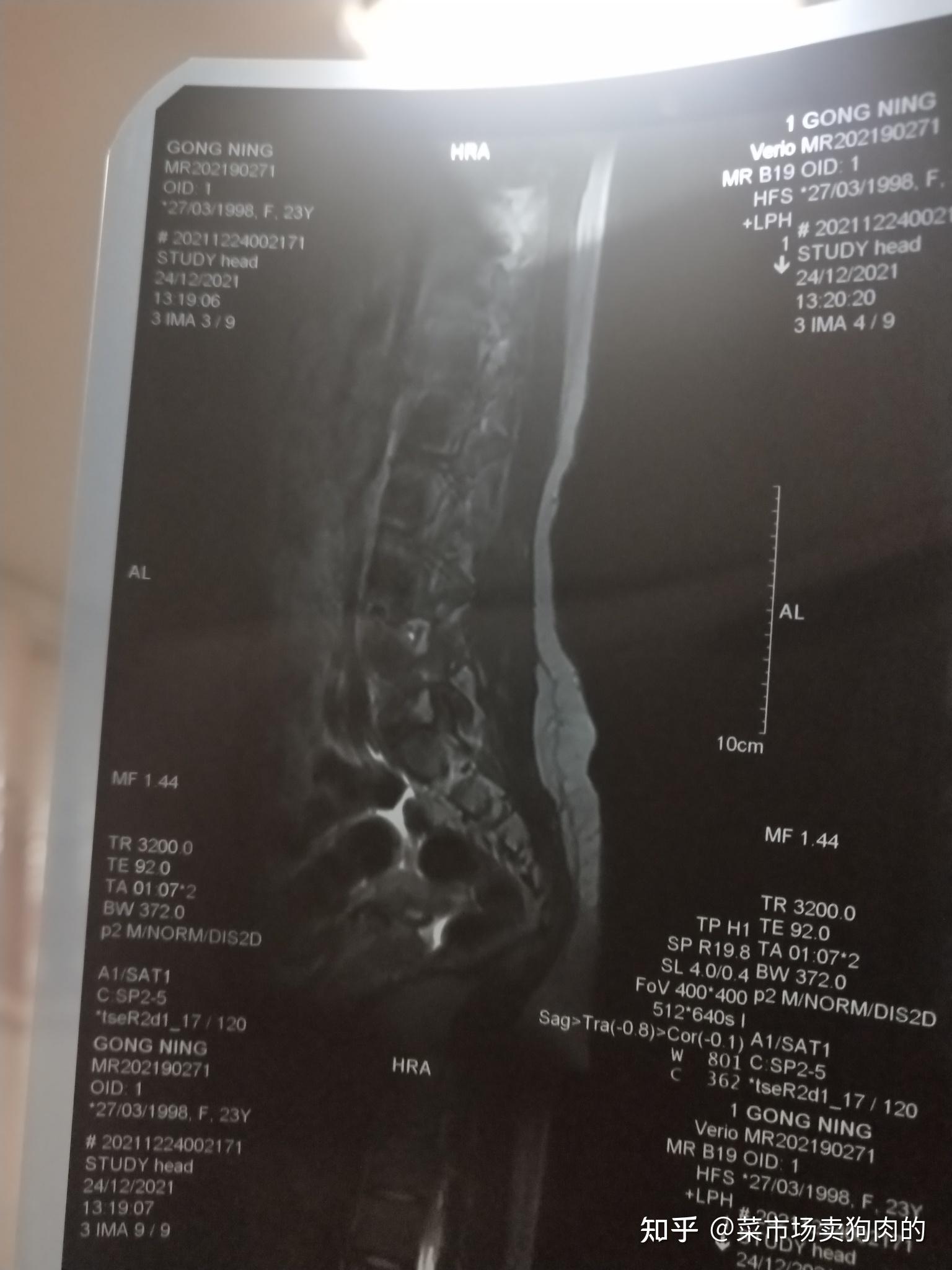 307医院挂号方法CT加急的简单介绍