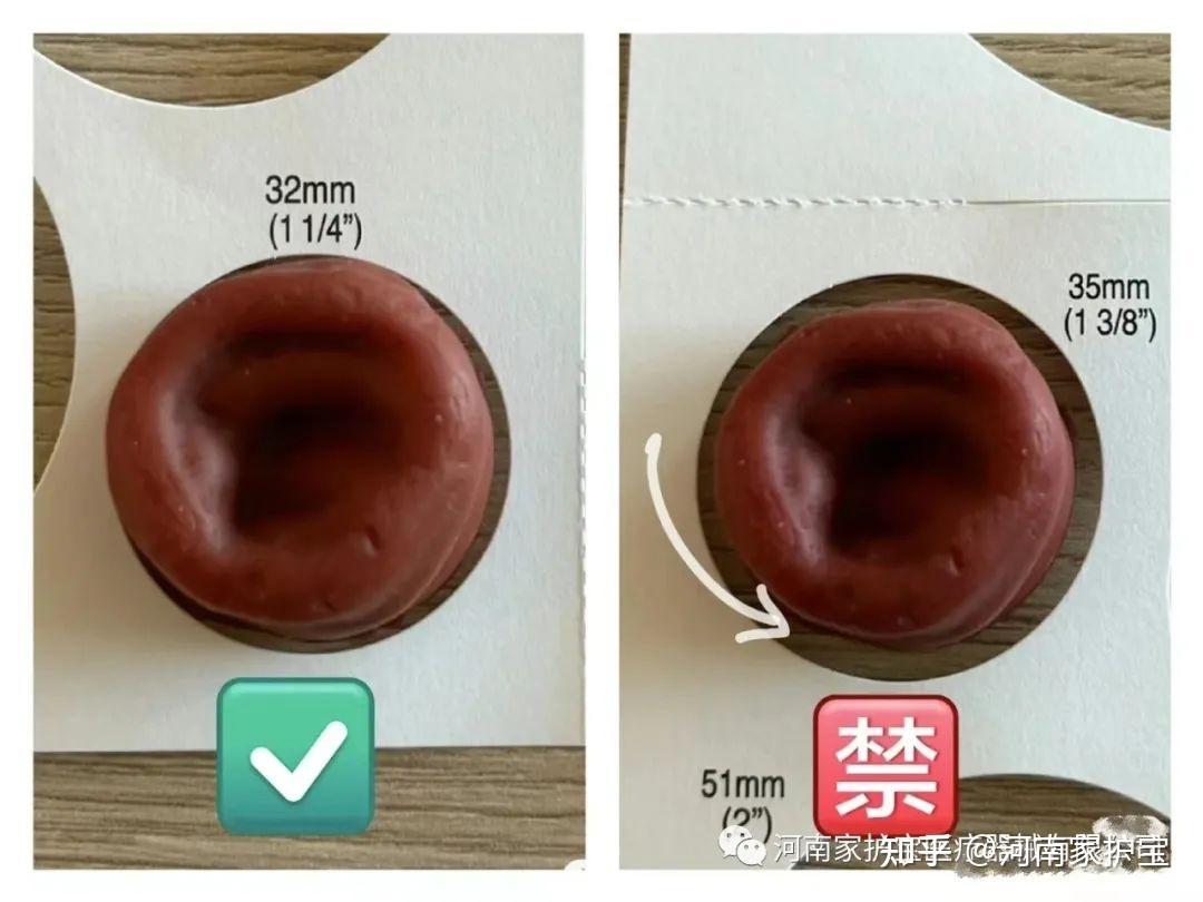 造口渗血的原因是什么? - 知乎