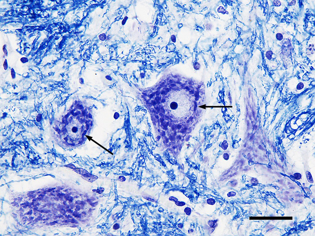 尼氏体是细胞器吗? - 知乎