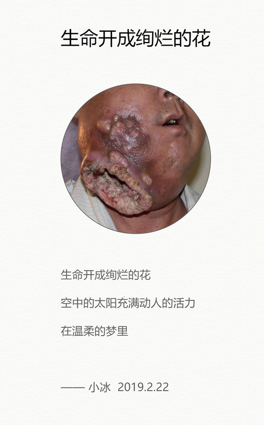 如何看待槟榔嚼出来的癌症槟榔致癌风险究竟有多大