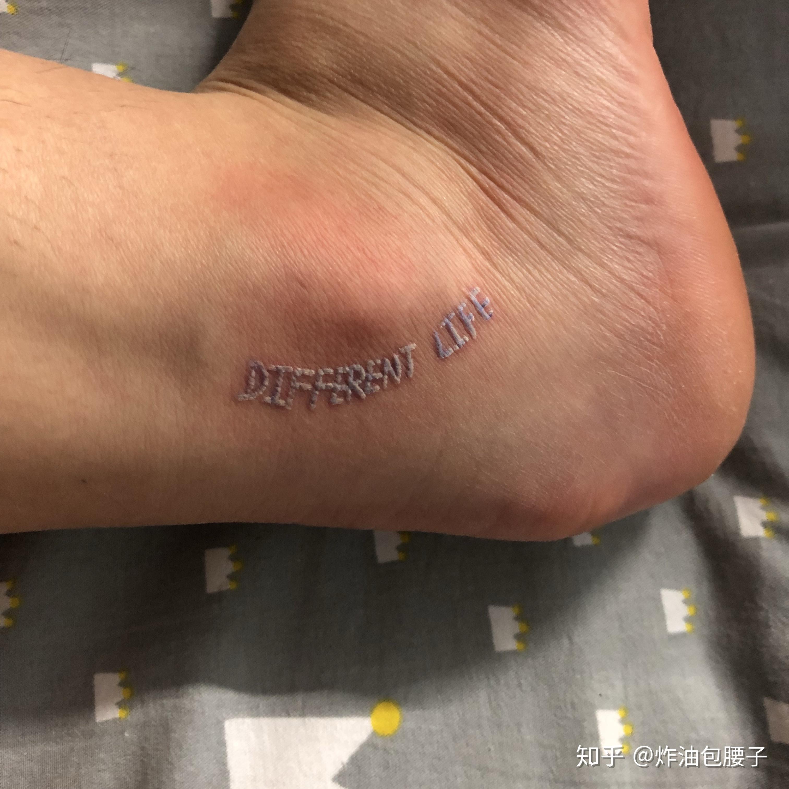 想纹个白色的纹身 有纹过白色的纹身的吗 有什么缺点吗?