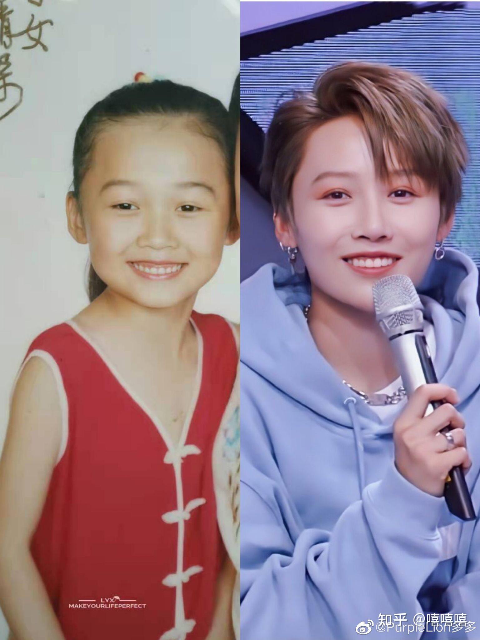 我觉得刘雨昕根本没有整容同意吗