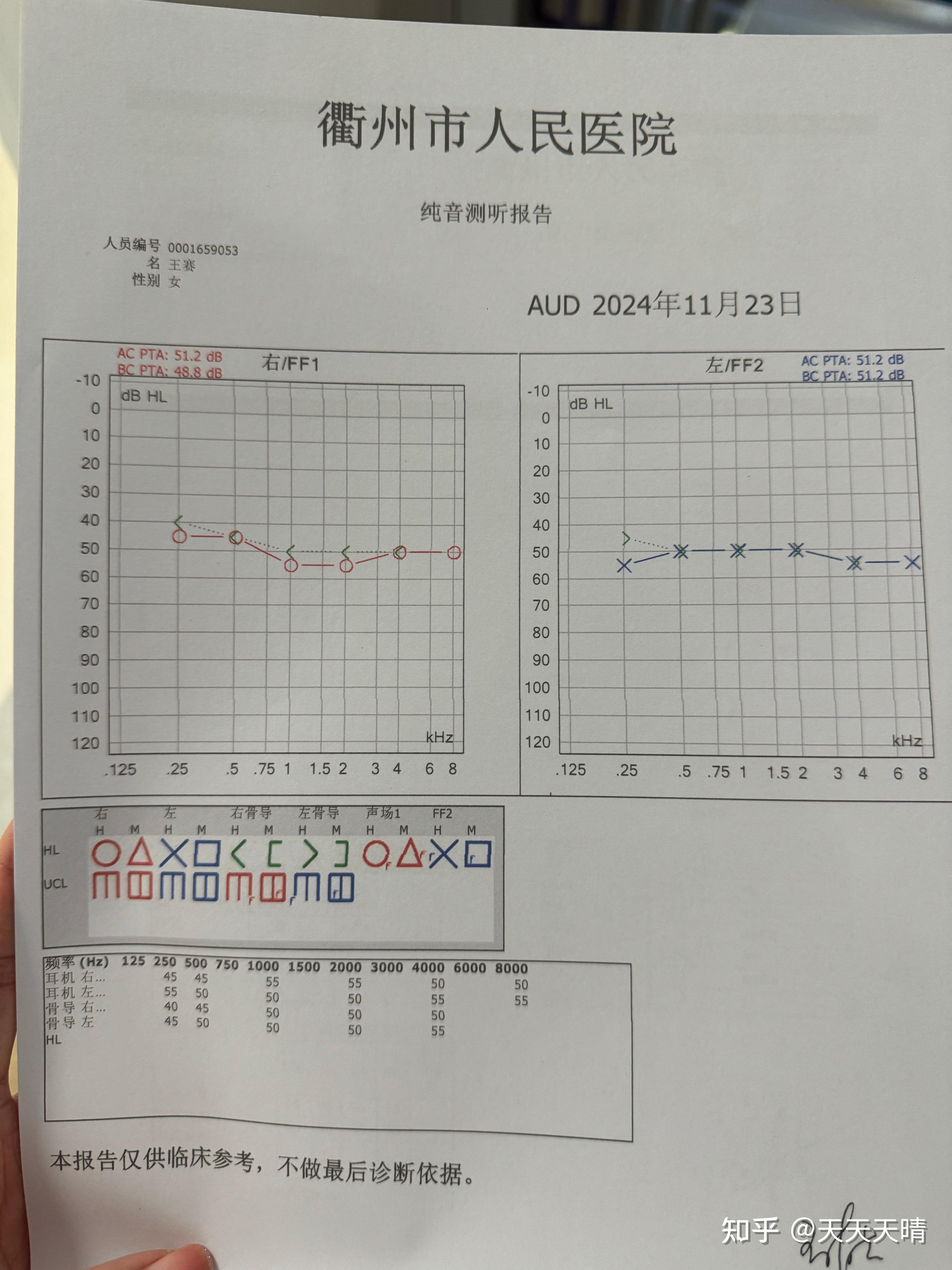 听力测试结果有大神帮忙看吗