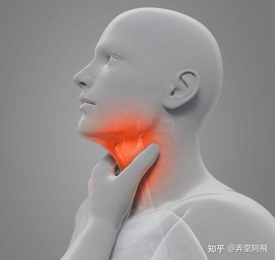 咽喉炎有哪些表现？致病原因是什么？该如何预防和治疗呢？ - 知乎