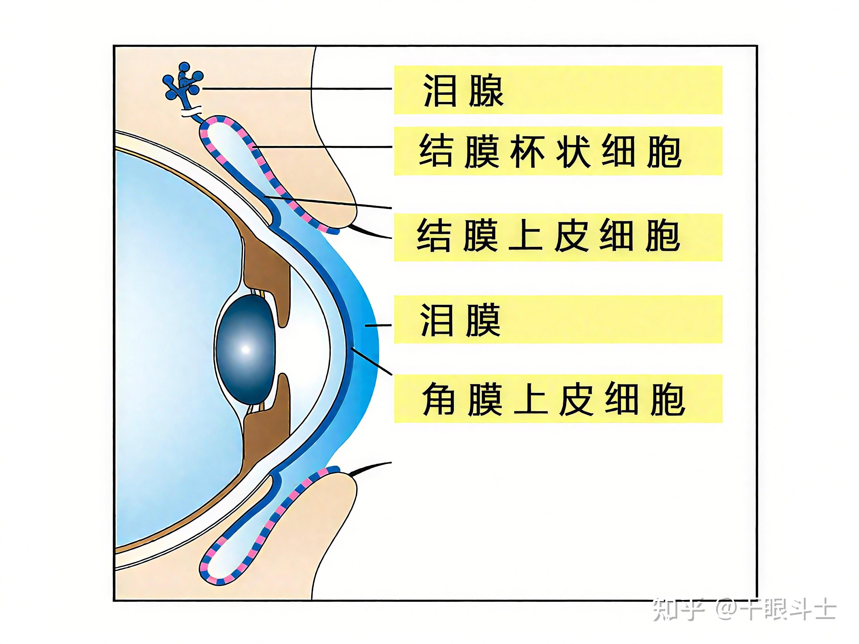 睑板腺堵塞了怎么办？——从绝望辞职到重获清晰视界的全攻略（亲测有效！）
