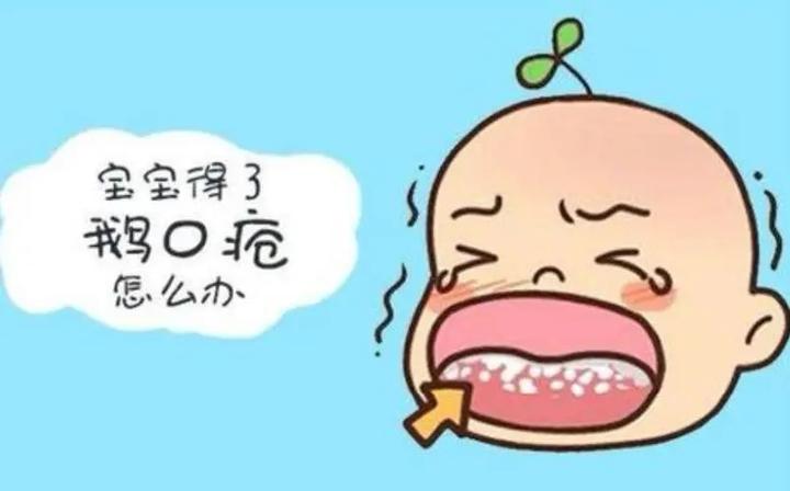 中医儿科杨晓：鹅口疮到底是什么？有哪些症状？如何预防调理？ - 知乎