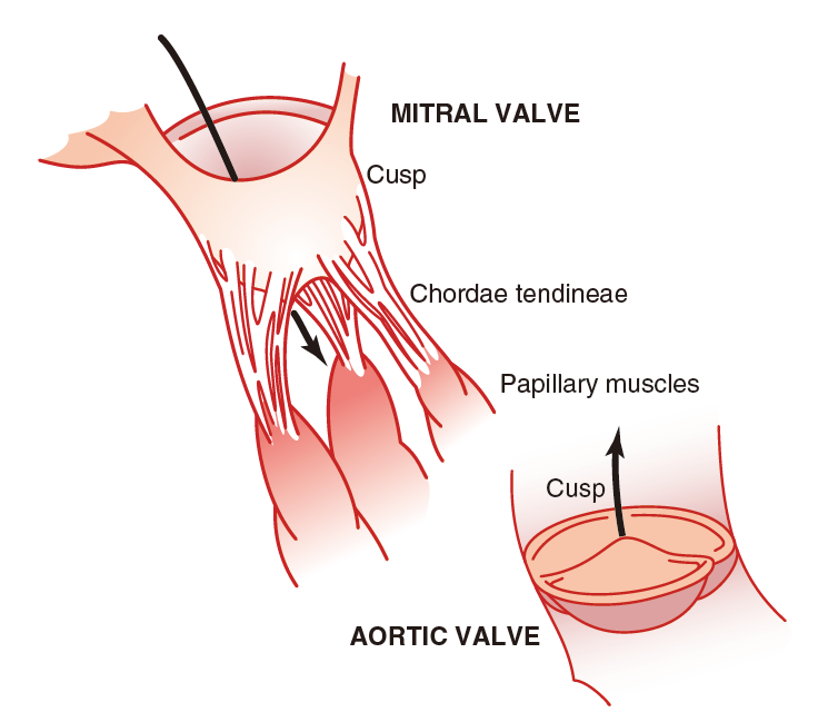 91年男今年做了心脏瓣膜手术不知道今后该何去何从
