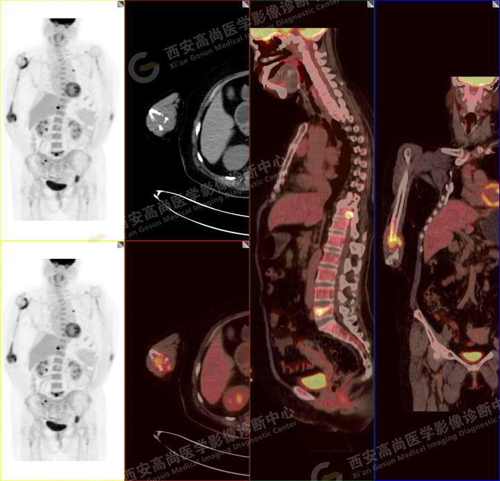 广安门医院代诊挂号服务流程复杂病例资料汇总，诊断更准确的简单介绍