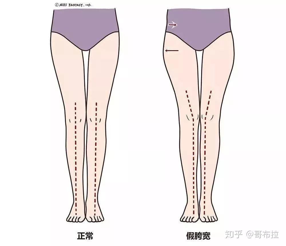 超级严重的梨形身材大腿前侧突出怎么办