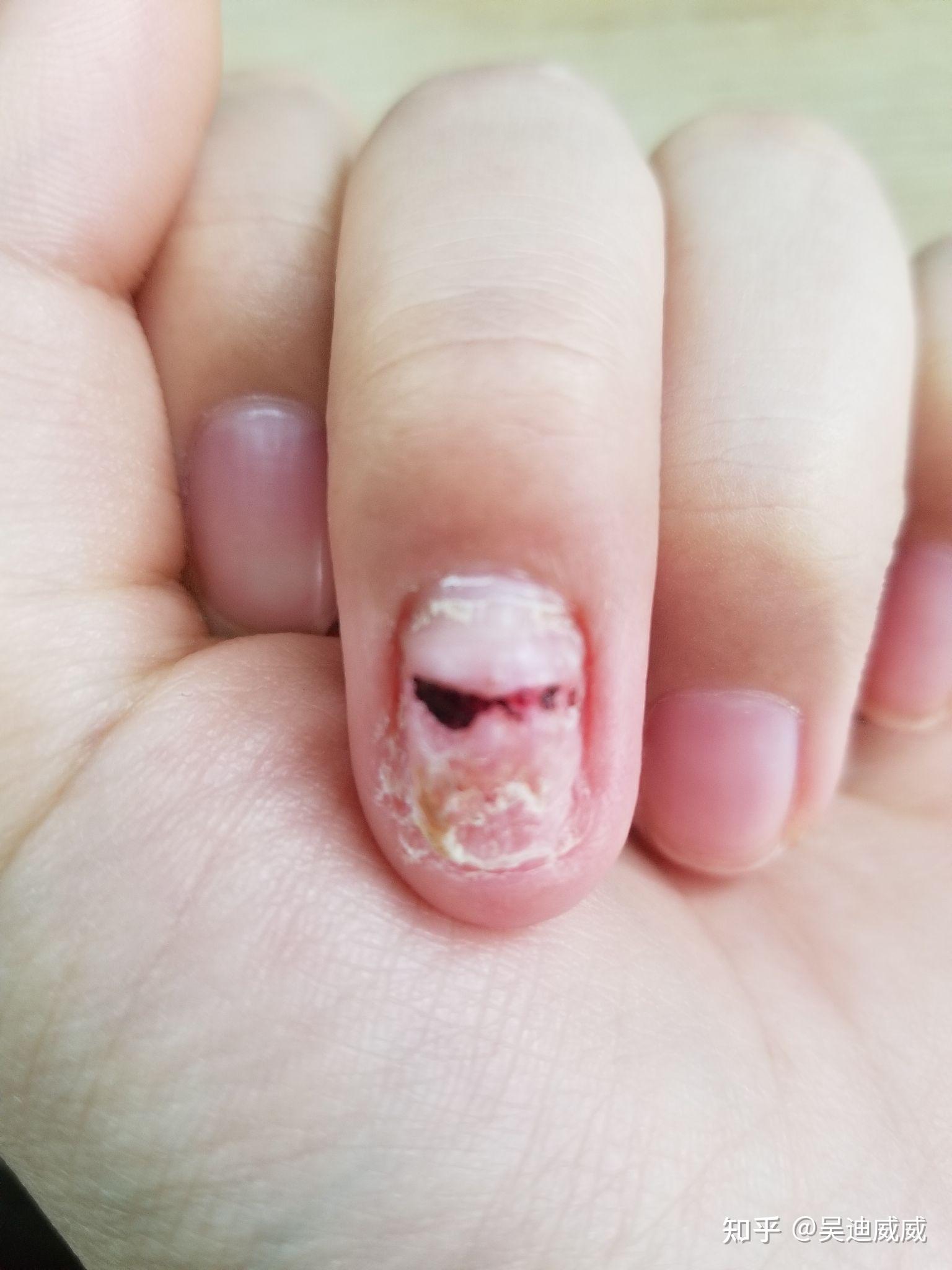 被门夹到手是一种什么体验? - 知乎