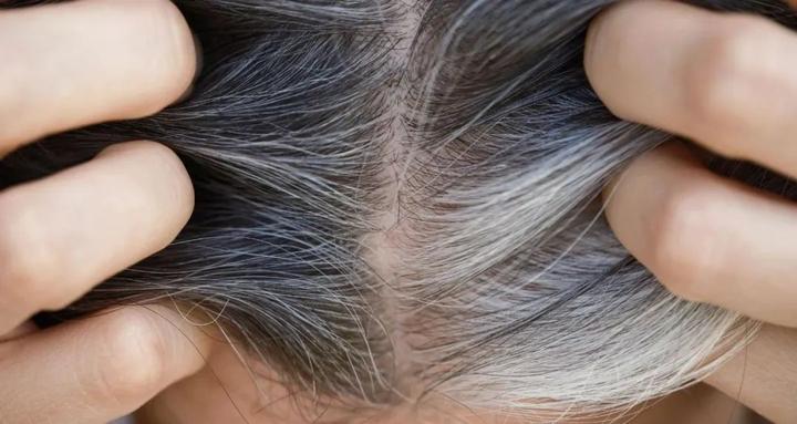 白发能转黑?Nature重磅发现:揭开头发变白的原因,为白发转黑带来希望 - 知乎