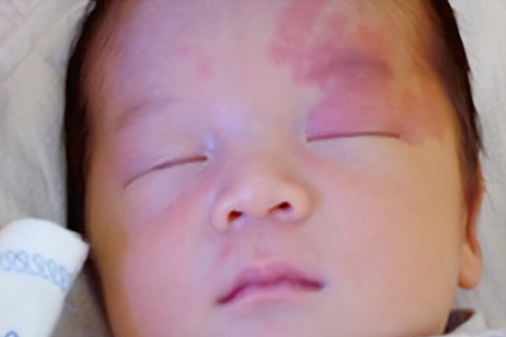 宝宝身上胎记怎么来?准爸妈3种行为容易使胎儿长胎记,尽量避开 - 知乎