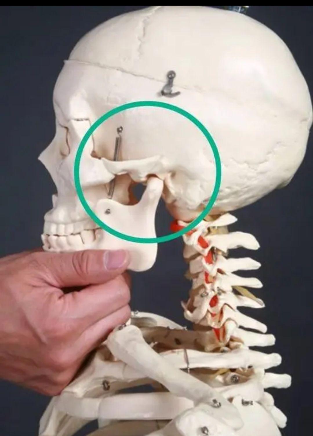 下颌关节错位后一直没有恢复? - 知乎