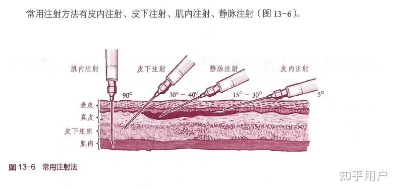 皮下注射皮内注射和肌肉注射的区别