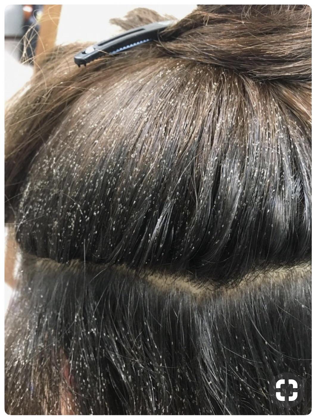 看到头发上有白色管状的类似头皮的东西? - 知乎