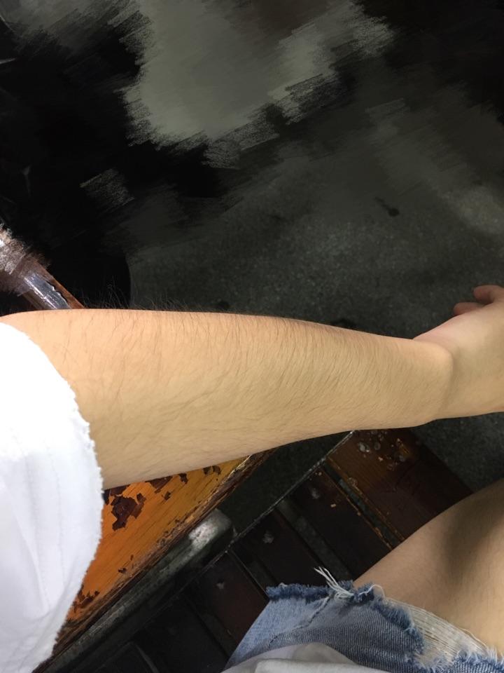 女生体毛旺盛是什么样的体验