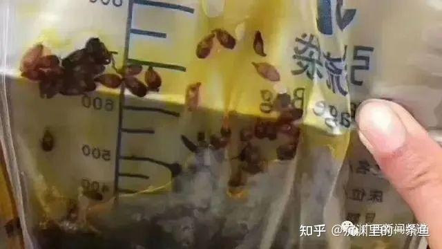 陈登吐出来的虫子是什么虫?