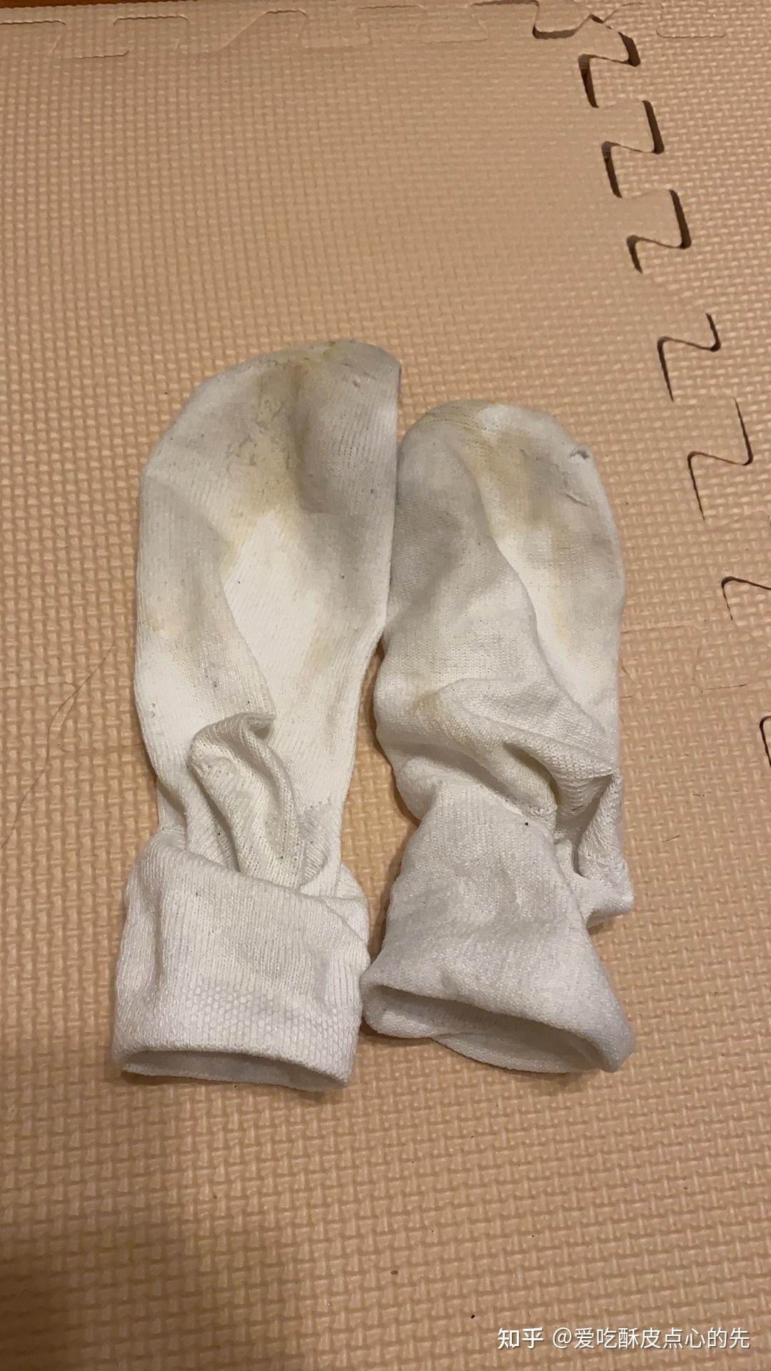 态极拖鞋发酸弄得脚又酸又臭怎么办