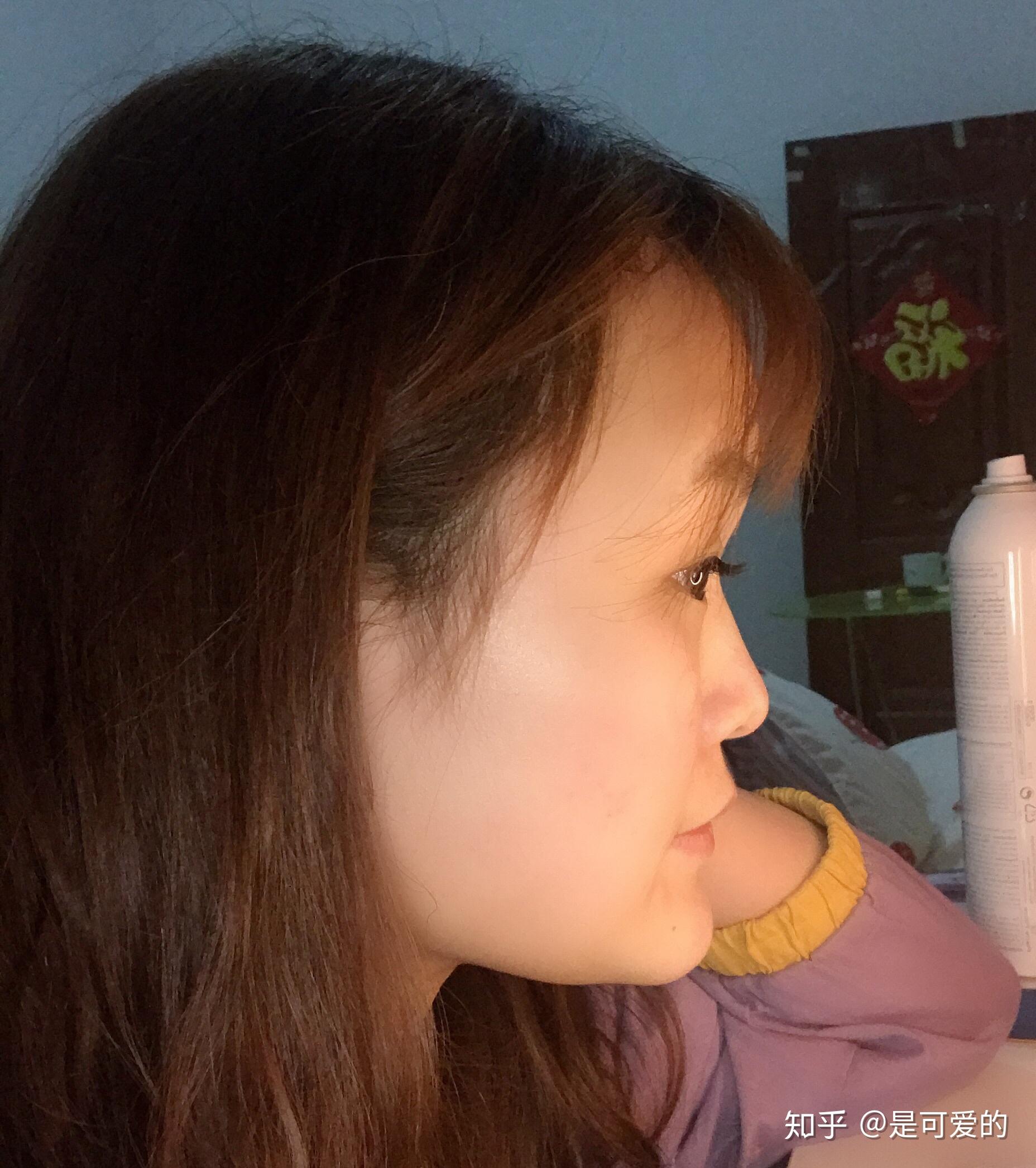 下巴前突但并不是地包天很自卑怎么办