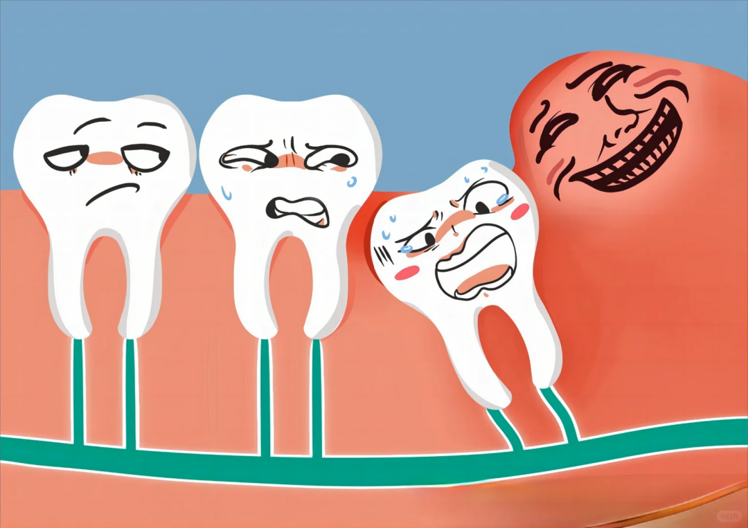 智齿冠周炎吃消炎药没用怎么办