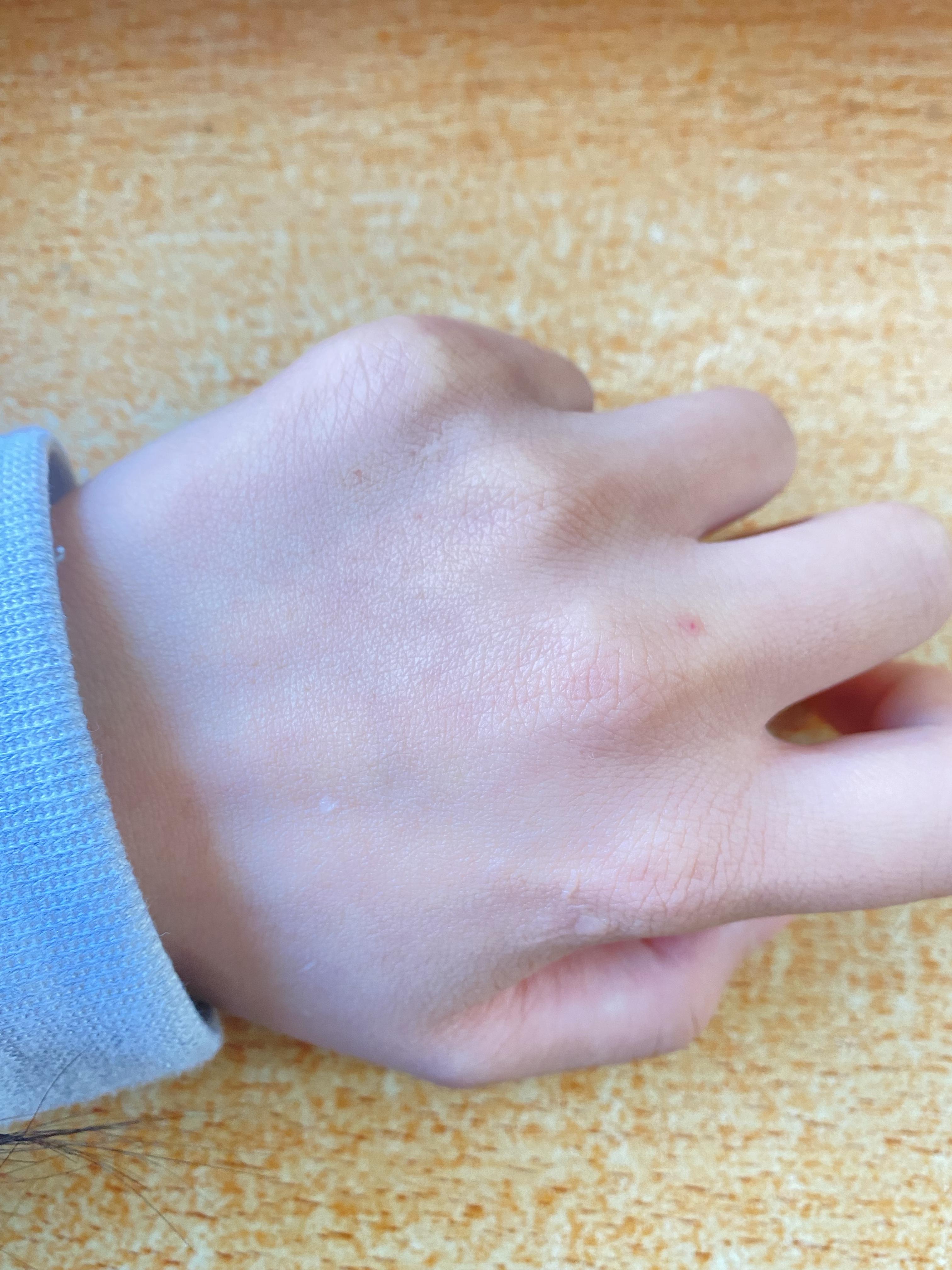 最近很火的朱砂痣长什么样