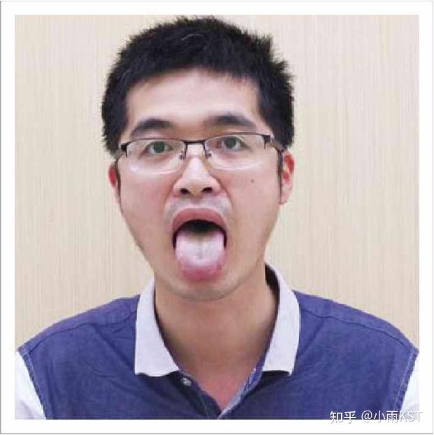 看舌头的内容与方法 - 知乎