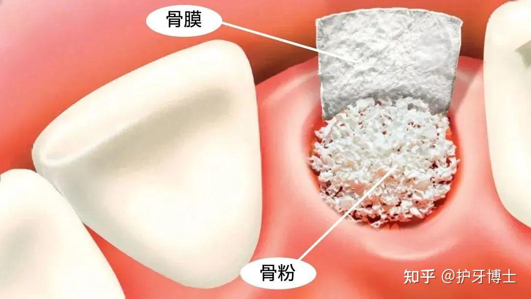 武漢種植牙什麼私立和公立醫院比較好性價比較高有沒有好醫生推薦一下