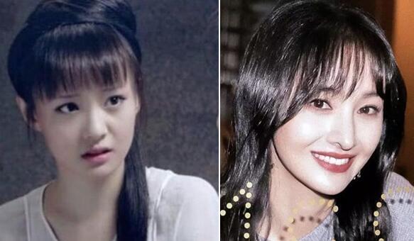 郑爽整容脸蹦了真的好可惜