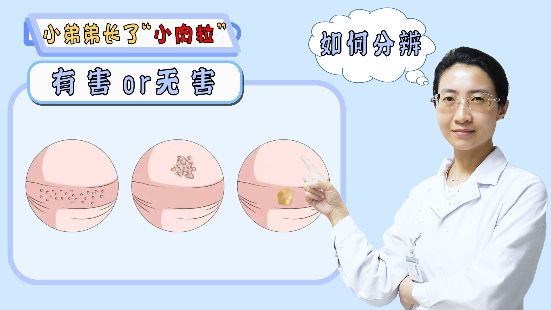 阴茎长了个小肉粒,不痛不痒,好怕吖? - 知乎